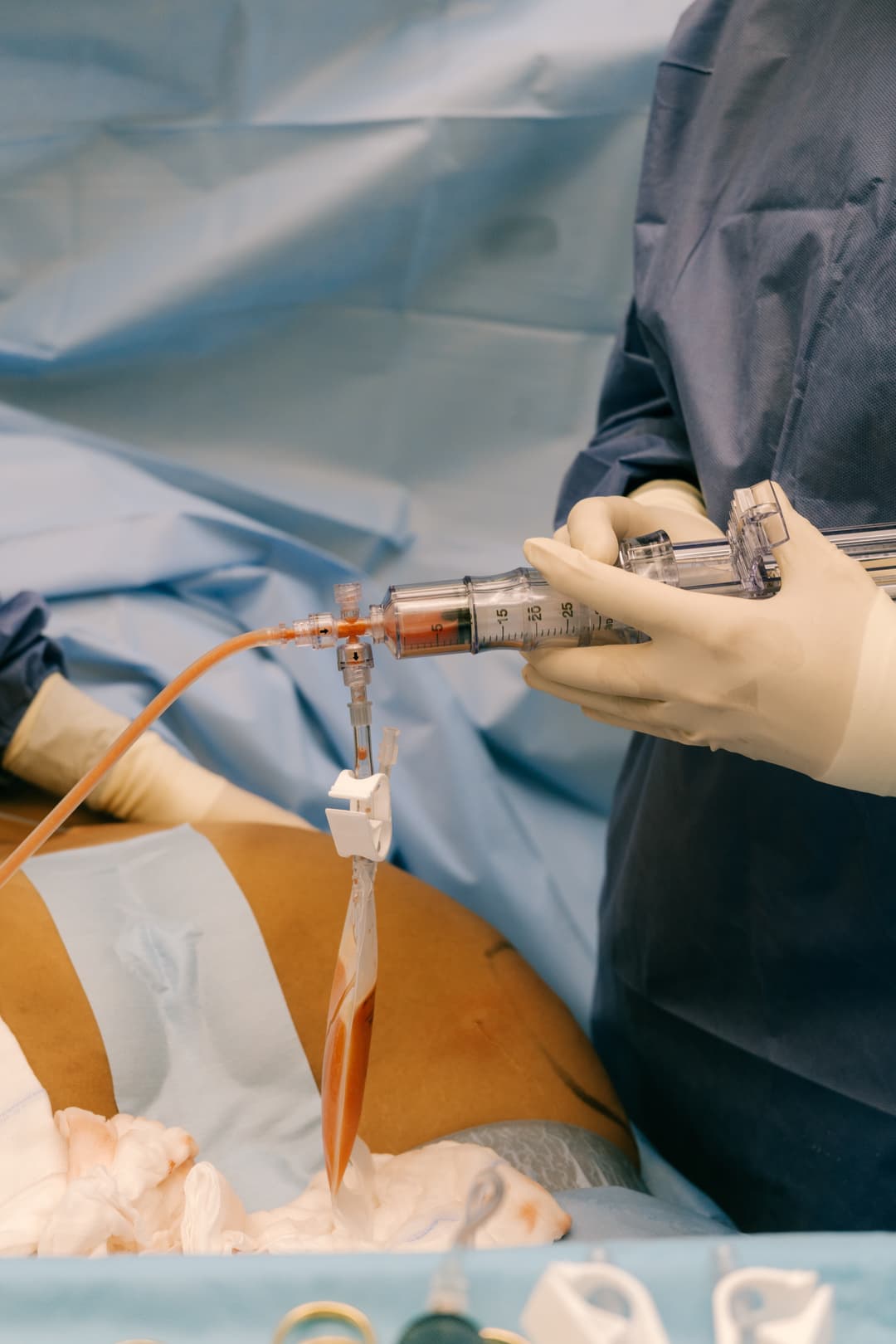 Combined Procedures